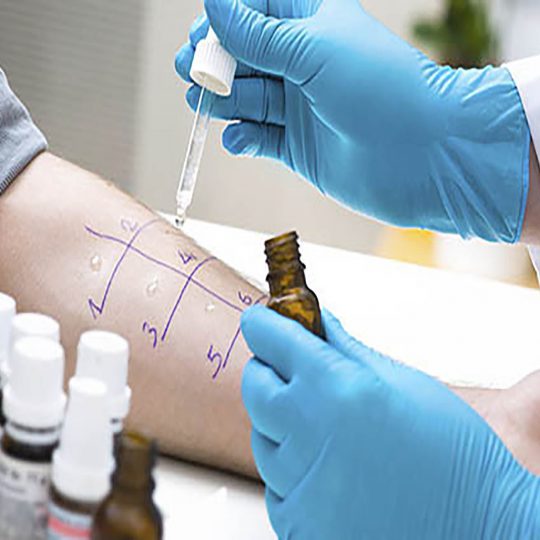 Allergy Testing Services Allergy Medik